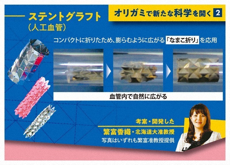Một dạng ghép stent sử dụng kỹ thuật Origami gọi là namako-ori